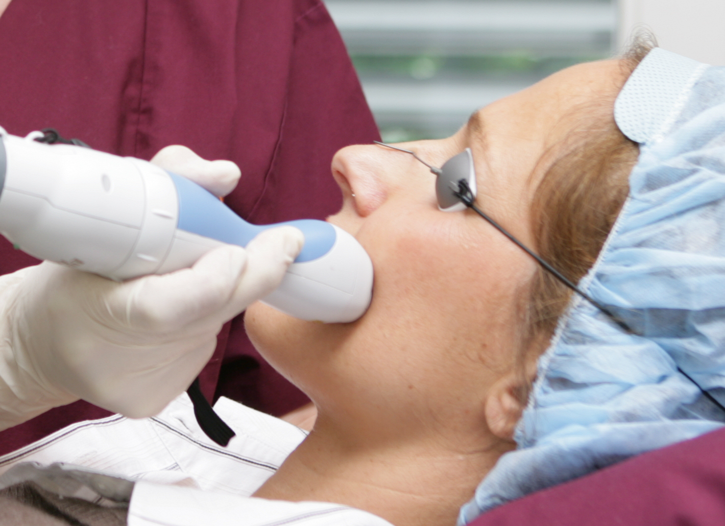Dermatologe f&auml;hrt w&auml;hrend der Laserbehandlung systematisch mit einem Handst&uuml;ck &uuml;ber die Haut