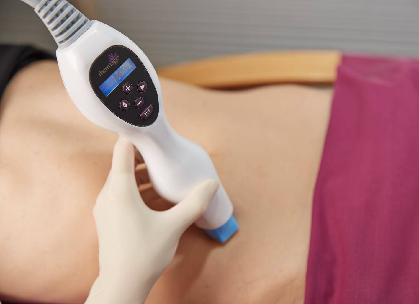 Mit dem Handst&uuml;ck von Thermage&reg; werden in der Rosenpark Klink systematisch Radiofequenzwellen zur Straffung der K&ouml;rperhaut eingesetzt.