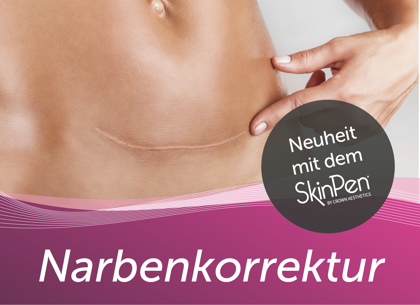 Narbenkorrektur